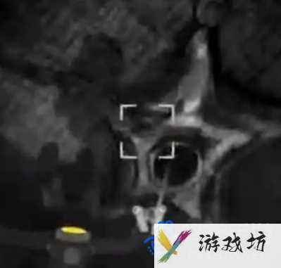 《内容警告》全怪物应对方法