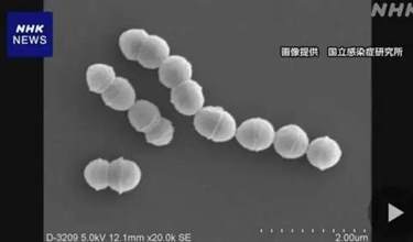 探秘日本迅速蔓延的‘食人菌’：链球菌中毒休克综合征的真相与防护