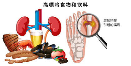 高嘌呤食物列表及其对健康的潜在风险