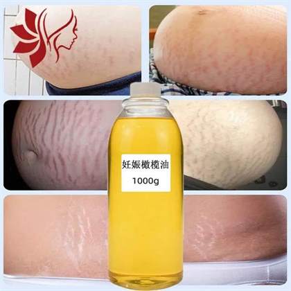 【最佳时机】去妊娠纹的油应何时开始使用？【口碑推荐】哪个牌子的去妊娠纹油效果最佳？